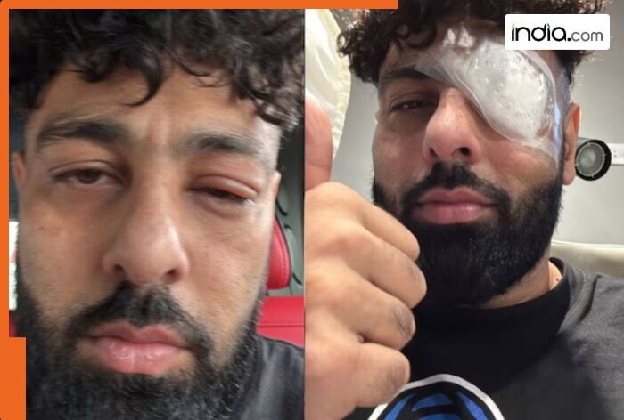 Rapper Badshah shares photos with swollen eye and bandage, fans ask ‘Kya hua bhai’